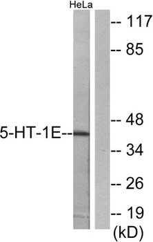 SR-1E antibody