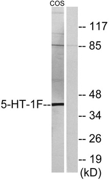 SR-1F antibody