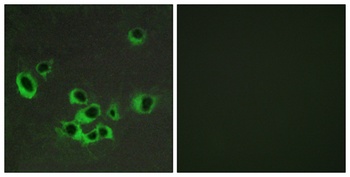 SR-2B antibody