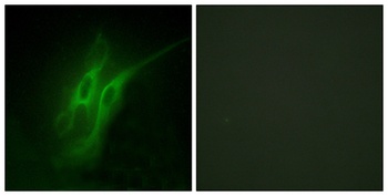 SR-4 antibody