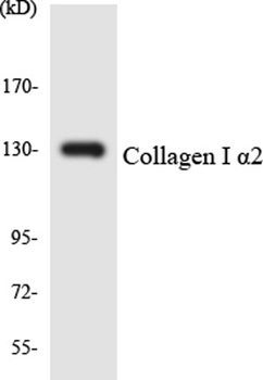 SR-4 antibody