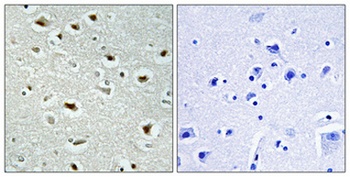 SRE-ZBP rabbit pAb Antibody