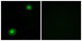 SRE-ZBP rabbit pAb Antibody