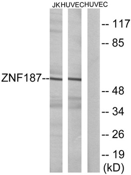SRE-ZBP rabbit pAb Antibody