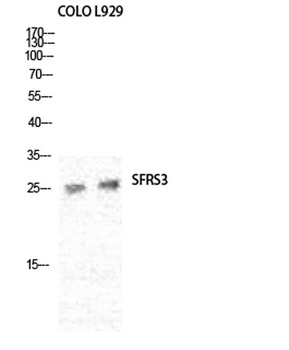 SRp20 rabbit pAb Antibody