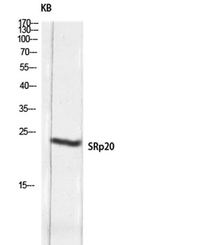 SRp20 rabbit pAb Antibody