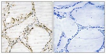 SRp75 antibody