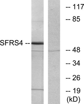 SRp75 antibody