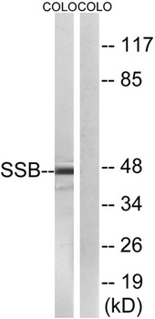 SSB rabbit pAb