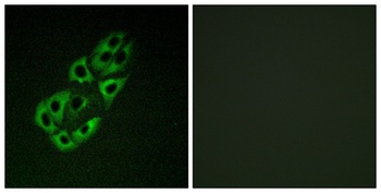 SSBP1 antibody