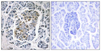 SSBP1 antibody