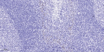 ST18 antibody