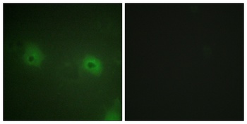 STAM2 antibody