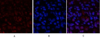 Stat1 antibody