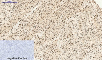 Stat1 antibody