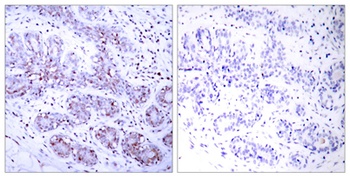 Stat4 antibody