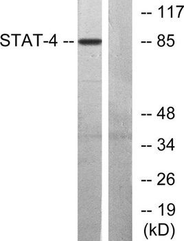 Stat4 rabbit pAb