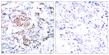 Stat5 antibody