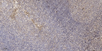 Stathmin-3 rabbit pAb
