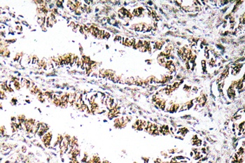 STEAP1 antibody