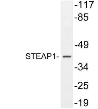 STEAP1 rabbit pAb
