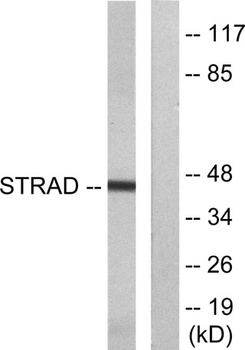 Strad antibody