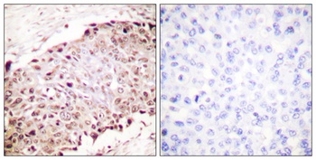 SUMO-1 antibody