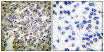 Synaptotagmin rabbit pAb