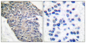 Synaptotagmin antibody