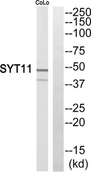 Synaptotagmin XI rabbit pAb