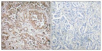 Synphilin-1 rabbit pAb