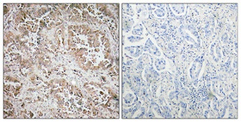 Synphilin-1 antibody