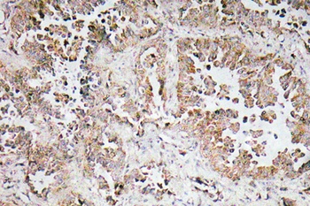 Synphilin-1 rabbit pAb
