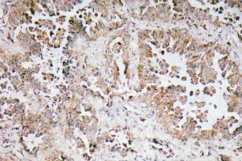 Synphilin-1 antibody