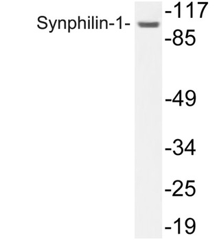 Synphilin-1 rabbit pAb