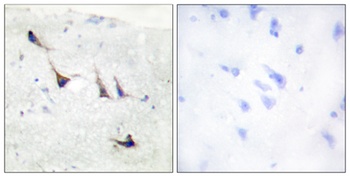 Syntaxin 1 rabbit pAb