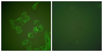 Synuclein-β rabbit pAb