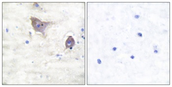 Synuclein-beta antibody