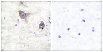 Synuclein-β rabbit pAb