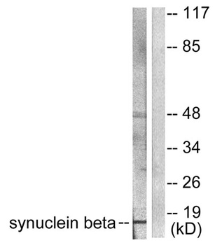 Synuclein-β rabbit pAb