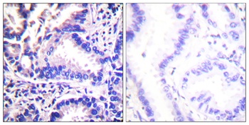 Synuclein-γ rabbit pAb Antibody