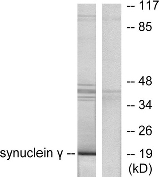 Synuclein-γ rabbit pAb Antibody
