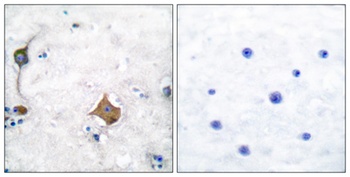 SYP antibody