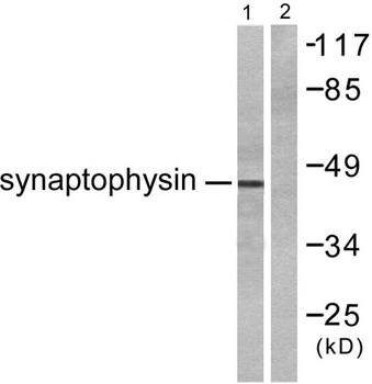 SYP antibody