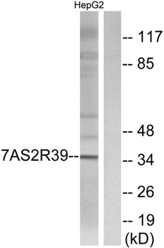 T2R39 antibody