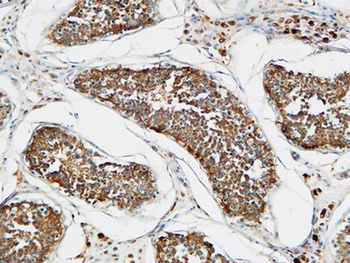 TACC3 antibody