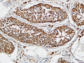 TACC3 antibody