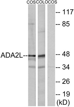 TADA2L antibody