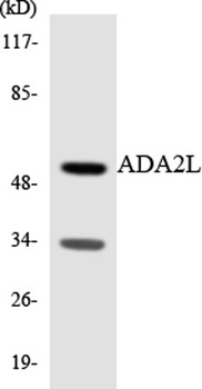 TADA2L antibody