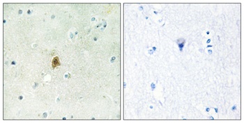 TAF II p68 antibody